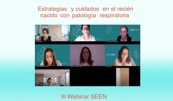 III Webinar SEEN 2025