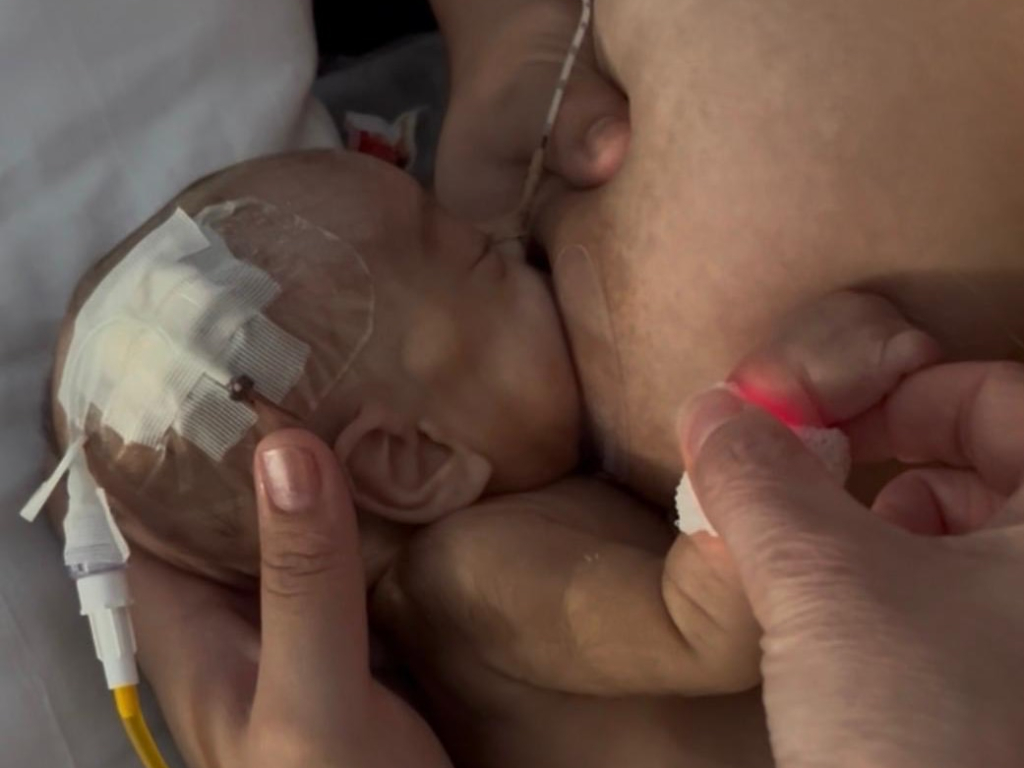 Duplicar la lactancia materna en neonatología es posible: el papel clave de la enfermería especializada