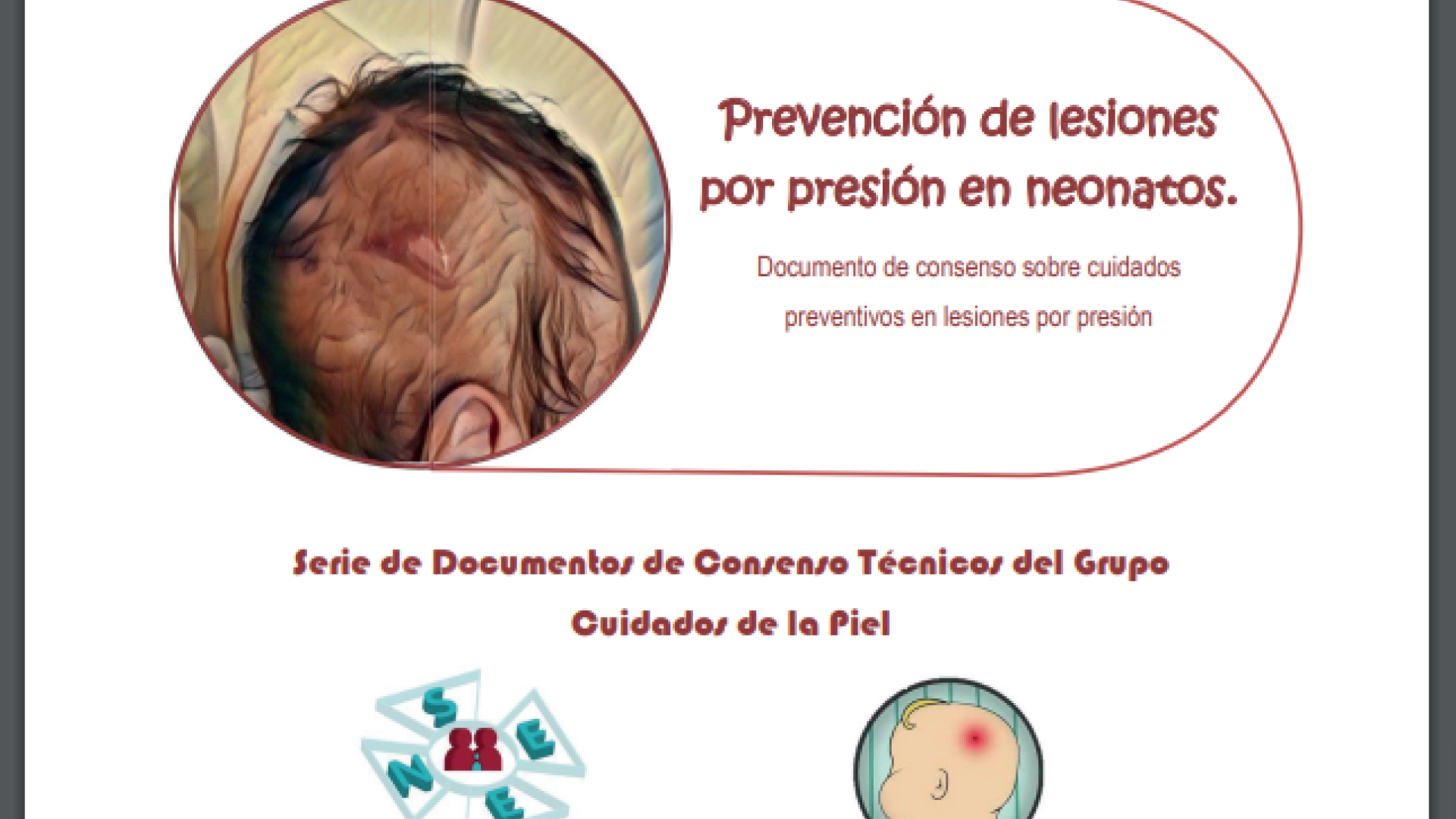 documento de consenso prevención lesiones por presión en neonatos